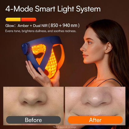 INIA GLOW 940 nm 4D LED Mask – Dual NIR 940 + 850 nm Deep Penetration for Deeper Repair