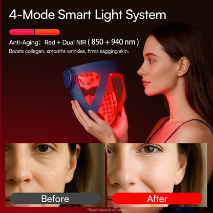 INIA GLOW 940 nm 4D LED Mask – Dual NIR 940 + 850 nm Deep Penetration for Deeper Repair