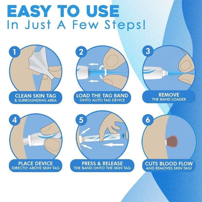 SMART Auto micro skin tag remover