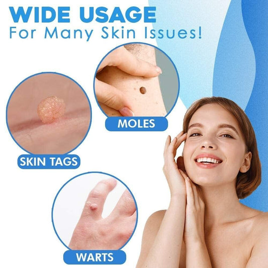 SMART Auto micro skin tag remover